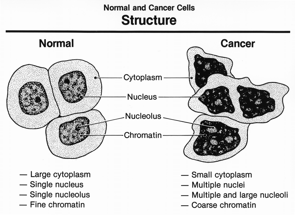 cancer_3